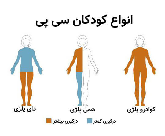 دسته بندی کودکان CP